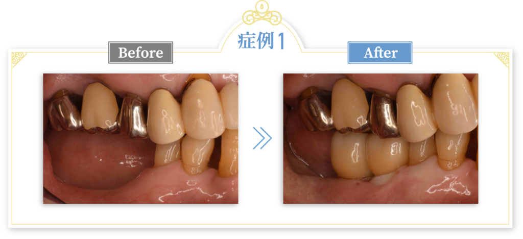 当院での症例紹介 症例1