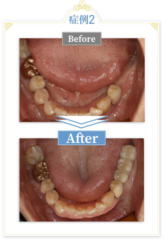 当院での症例紹介 症例2