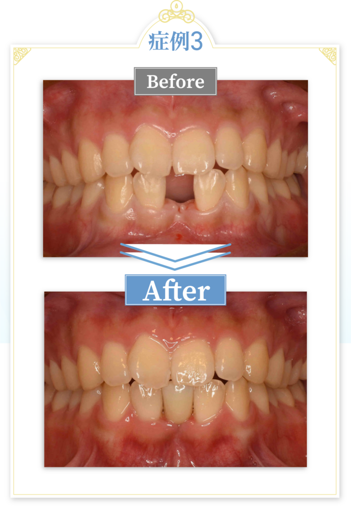 当院での症例紹介 症例3