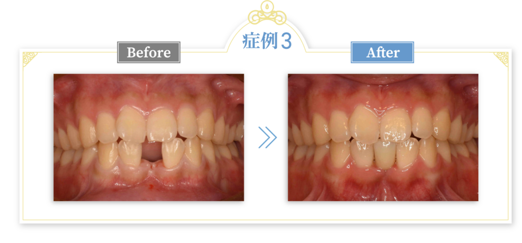 当院での症例紹介 症例3