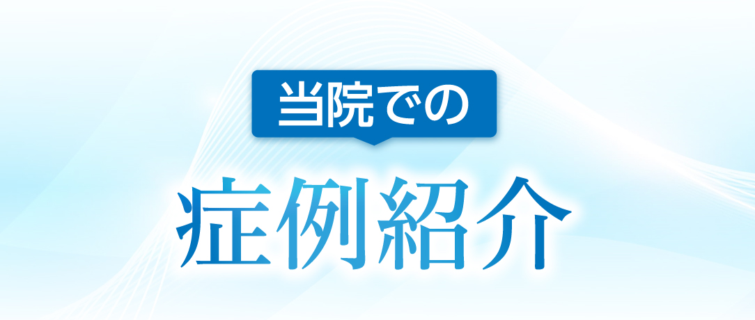 当院での症例紹介