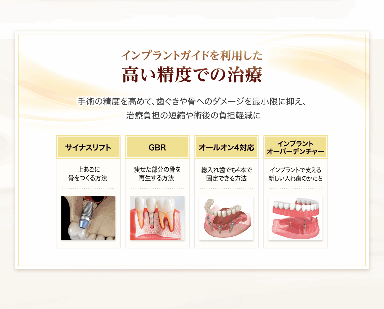 インプラントガイドを利用した高い精度での治療