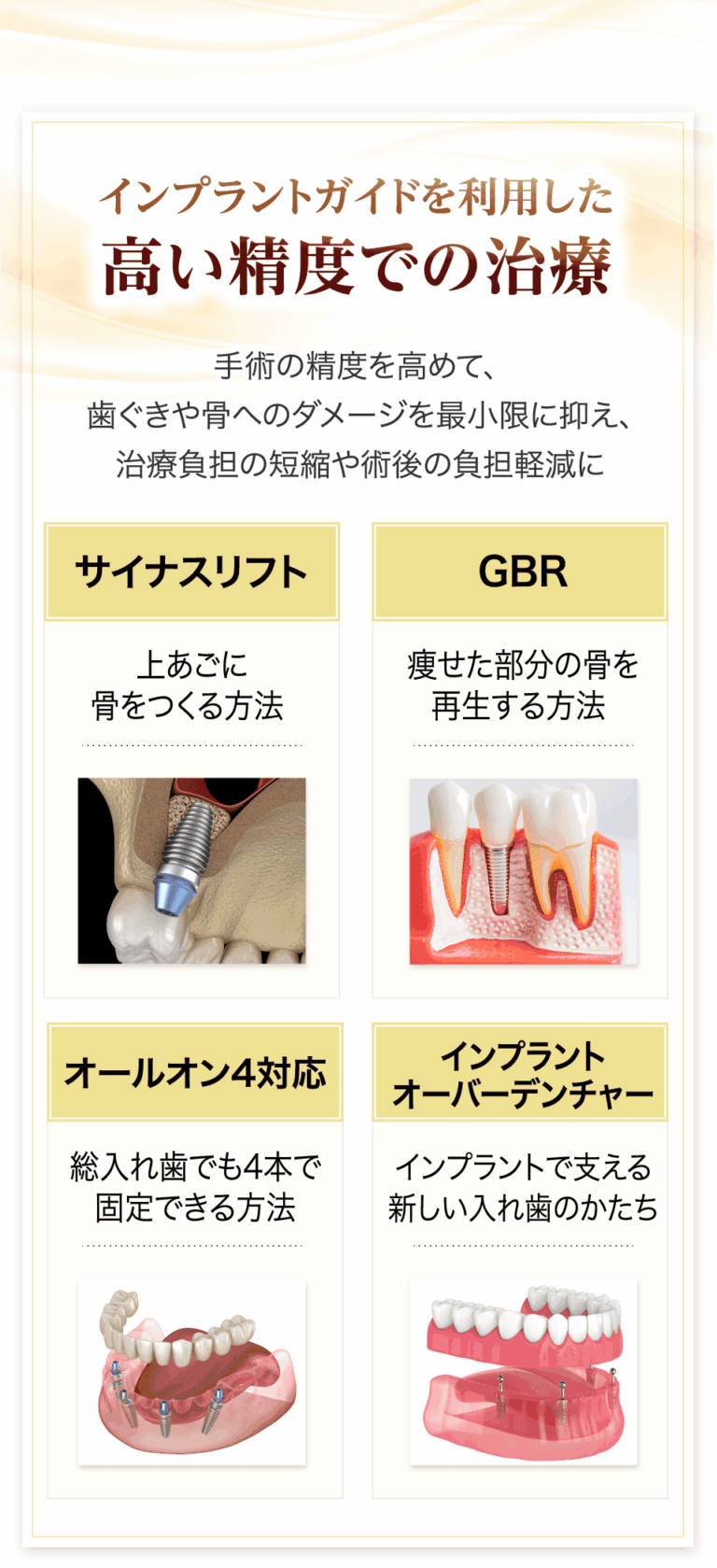 インプラントガイドを利用した高い精度での治療
